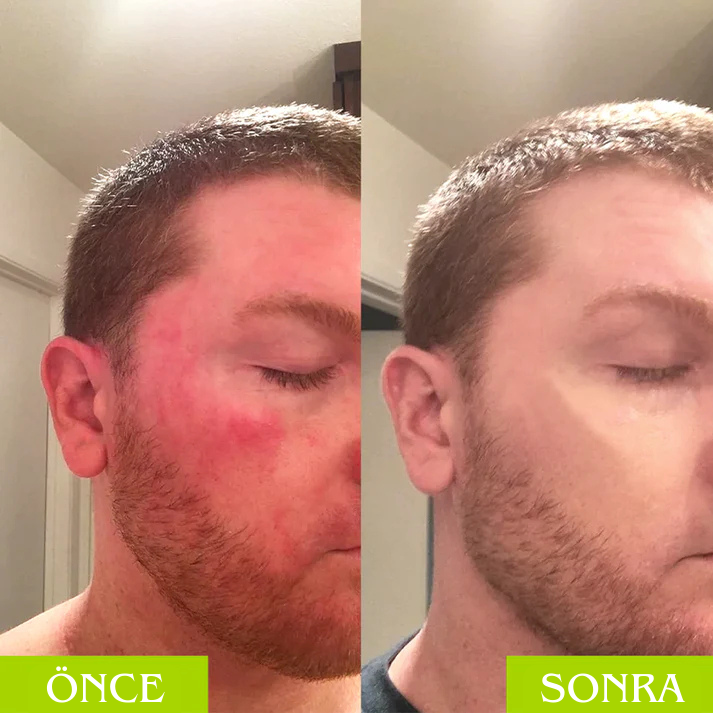 Radiant Wellness Detoks Formülü